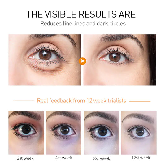 Vibrating Results Dark Circle Removal Eye Renewal Cream remove wrinkles