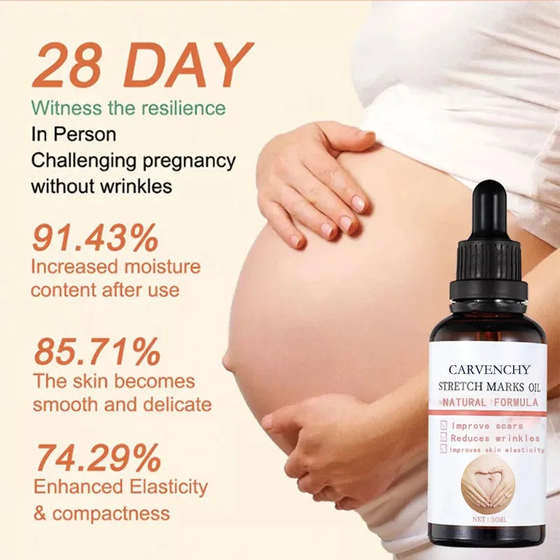 Stretch Marks Remover Essential Oil Pregnancy Maternity Body New Old Stretch Mark Removal Serum Increase Elasticity of Skin