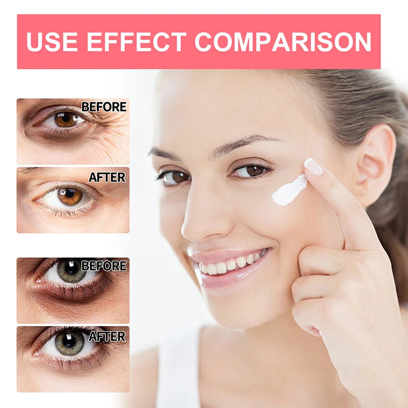 Retinol Anti-Wrinkle Eye Cream Stick Anti Aging Get Rid Of Puffy Dark Circles Eye Bags Lifting Moisturizing Health Repairing Eye