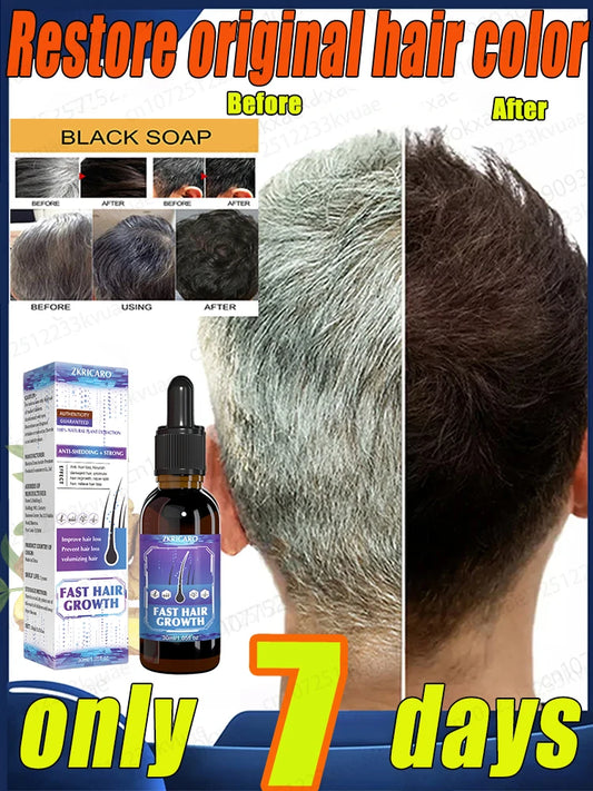 Turn white hair into black hair, remove gray hair in 7 days and restore natural and healthy hair color