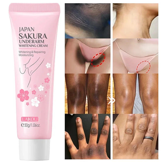 Whitening Cream For Dark Skin Armpit Thigh Inner Joint Lightening Intimate Area Underarm Body Care Private Parts Brighten Lotion
