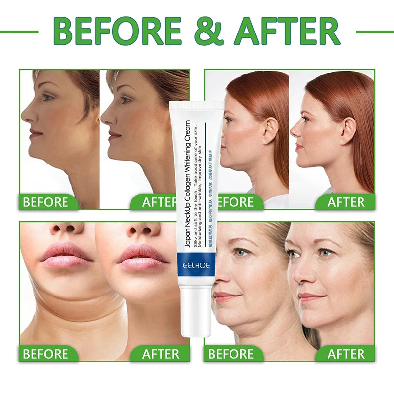 Collagen Neck Lifting and Remove Double Chin Neck Anti-ageing Brightening Moisturizer Remove fine lines