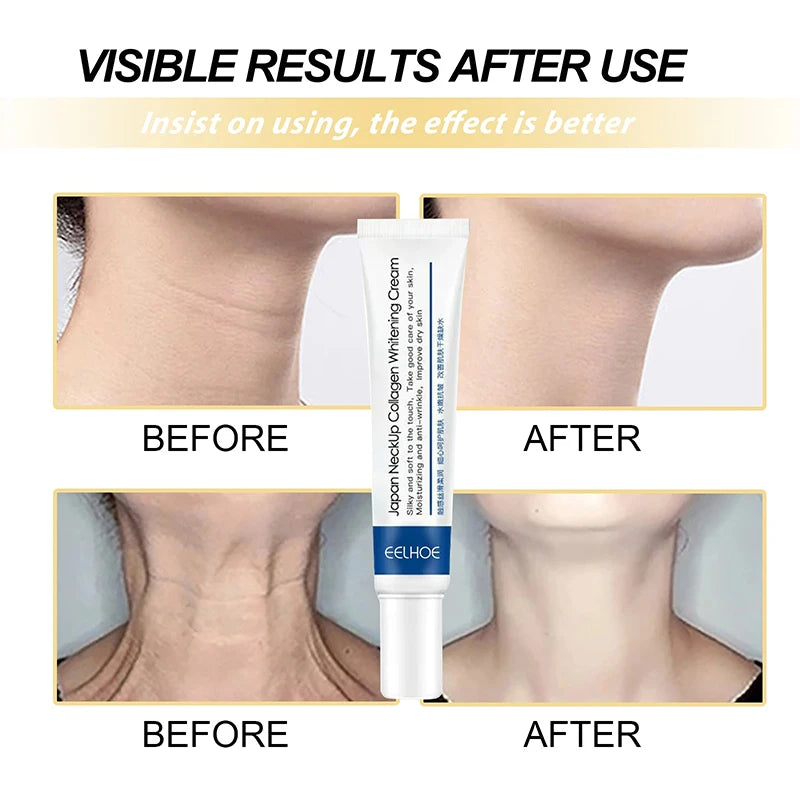 Collagen Neck Lifting and Remove Double Chin Neck Anti-ageing Brightening Moisturizer Remove fine lines