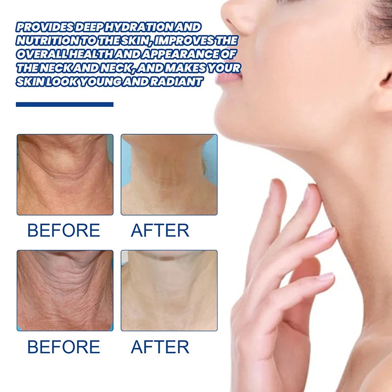 Collagen Neck Lifting and Remove Double Chin Neck Anti-ageing Brightening Moisturizer Remove fine lines